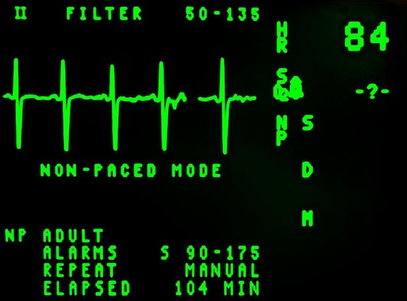 Monitoring Pulse Connect Secure With Splunk (CISA Emergency Directive 21-03)