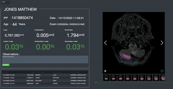 Splunk at the service of medical staff