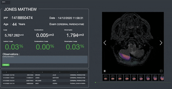 Splunk at the service of medical staff